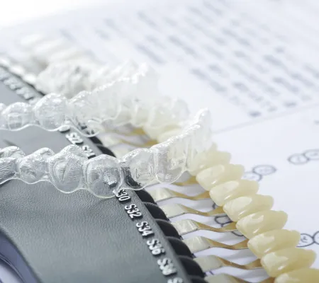 マウスピースの型取り