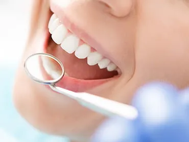 デュアルホワイトニング